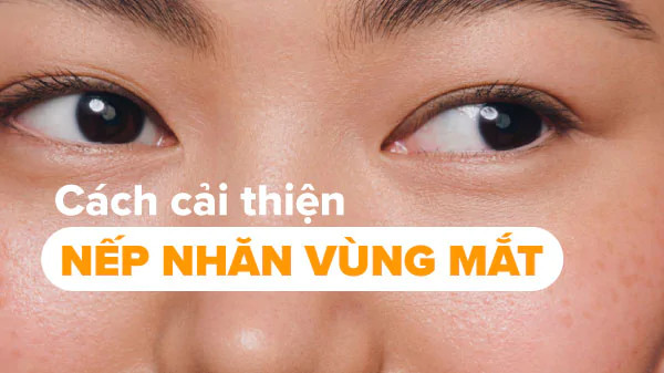 alt: Hình ảnh cận cảnh vùng da mắt với nếp nhăn