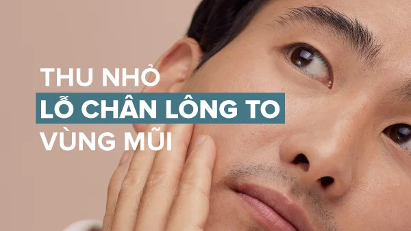 alt text: Hình ảnh làn da vùng mũi với lỗ chân lông to