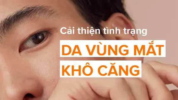 alt text: Hình ảnh vùng da quanh mắt bị khô, bong tróc cần được chăm sóc đặc biệt.