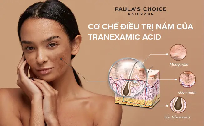 alt text: Sơ đồ minh họa cơ chế trị nám của Tranexamic Acid