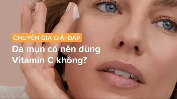 alt=Da mụn có nên dùng vitamin C?