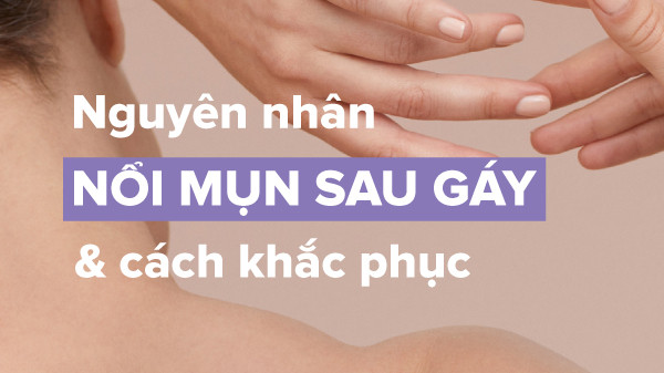 nguyên nhân nổi mụn sau gáy, nguyên nhân bị nổi mụn sau gáy