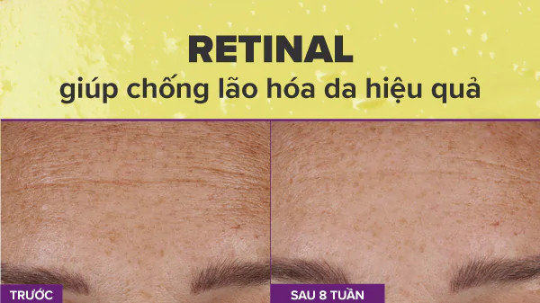 Retinal giúp ngăn ngừa lão hóa da