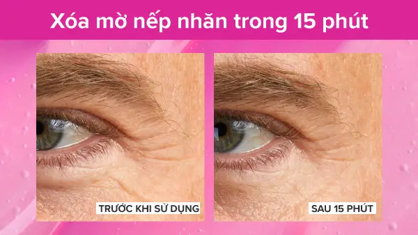 Tinh chất xóa mờ nếp nhăn trong 15 phút