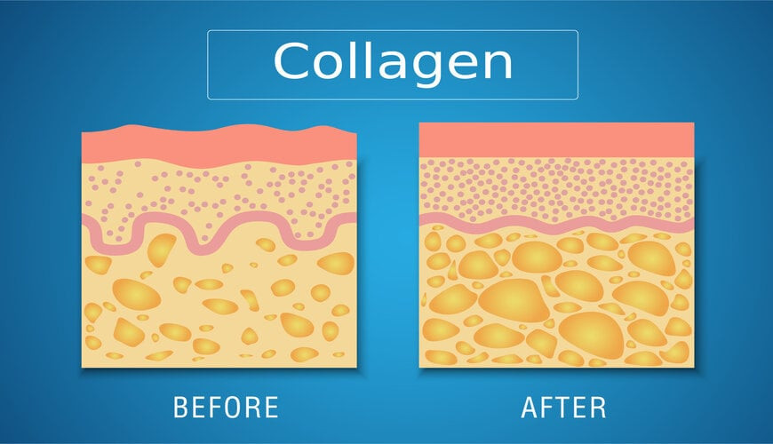 Collagen là gì? Bổ sung collagen cho da như thế nào mới hiệu quả?