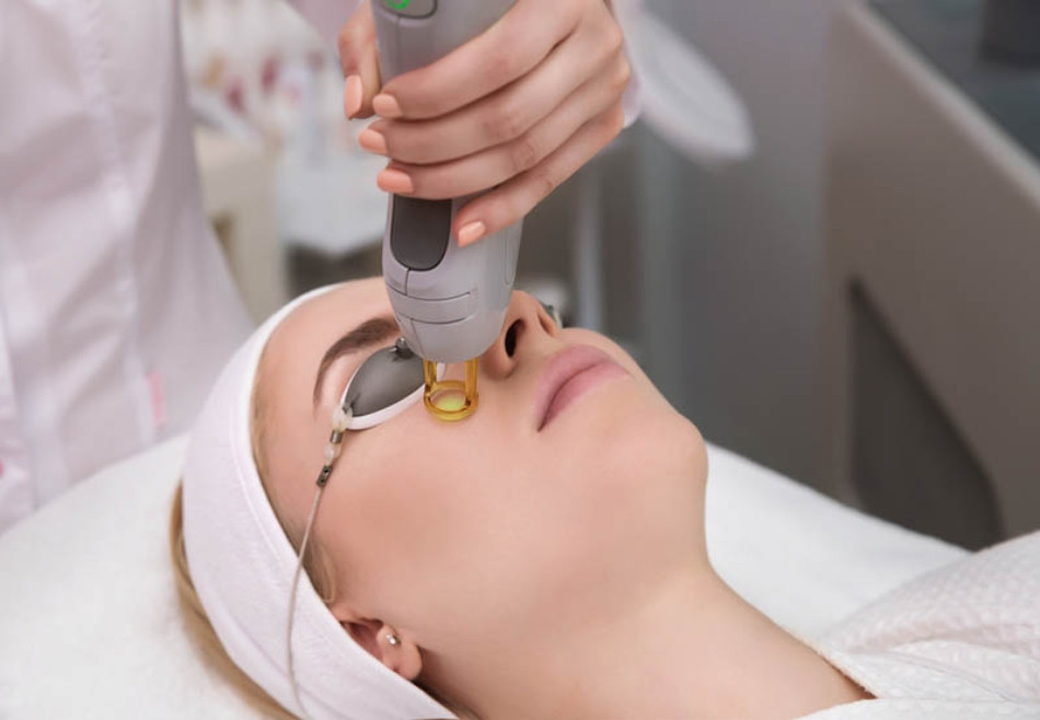 Dùng laser YAG để loại bỏ đồi mồi