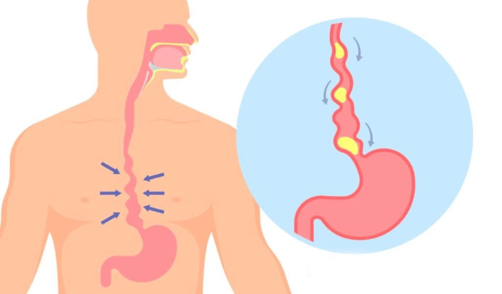 Gạo lứt đen tốt cho tiêu hóa