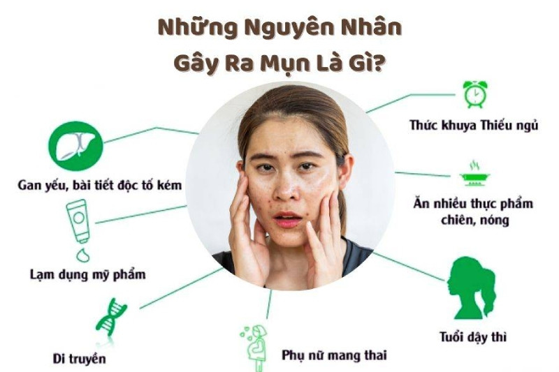 Những nguyên nhân gây ra tình trạng da dầu mụn là gì?