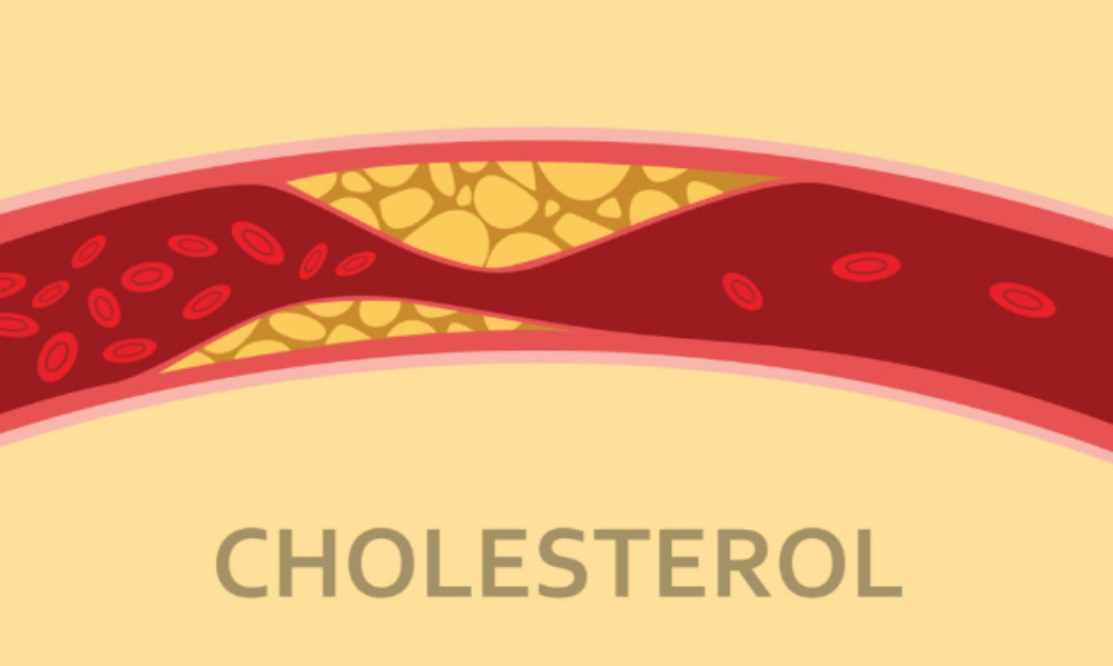 Nước đỗ đen gạo lứt giúp kiểm soát lượng Cholesterol trong máu