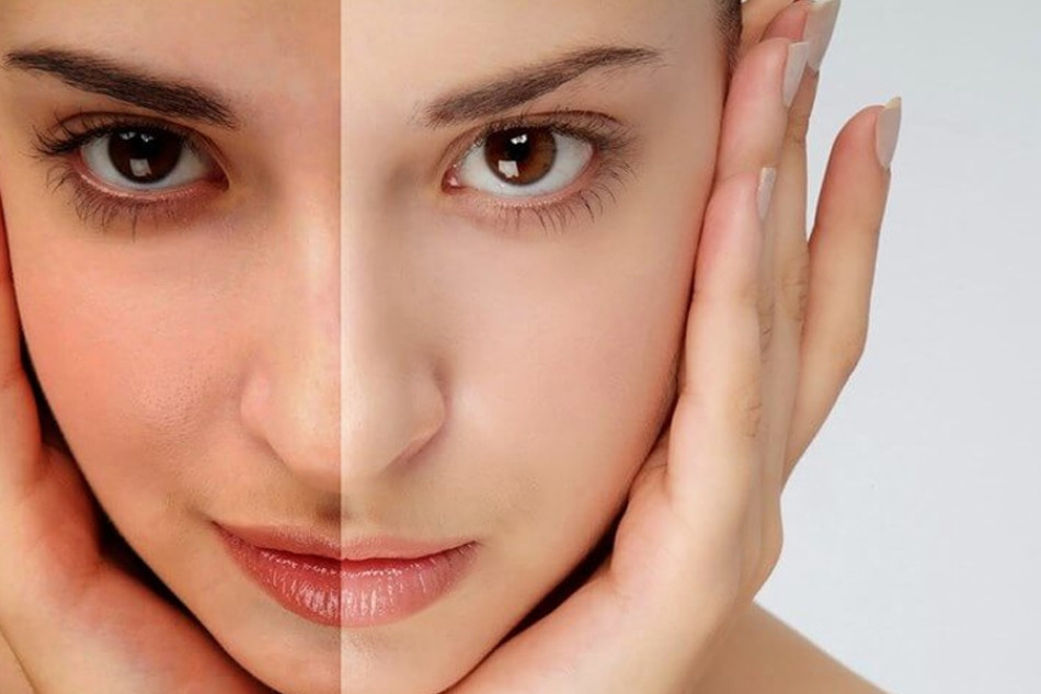 Skincare không dùng kem chống nắng