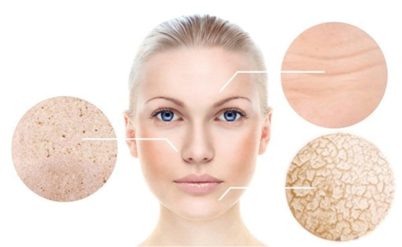 9 bước skincare cho da khô lỗ chân lông to đầy đủ và hiệu quả nhất