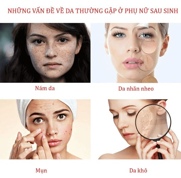 Top 9 Kem Dưỡng Trắng Da Hiệu Quả và An Toàn