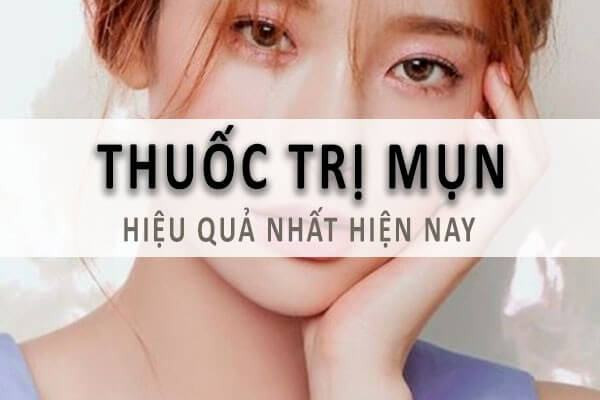 Cach tri mun theo don thuoc an toan