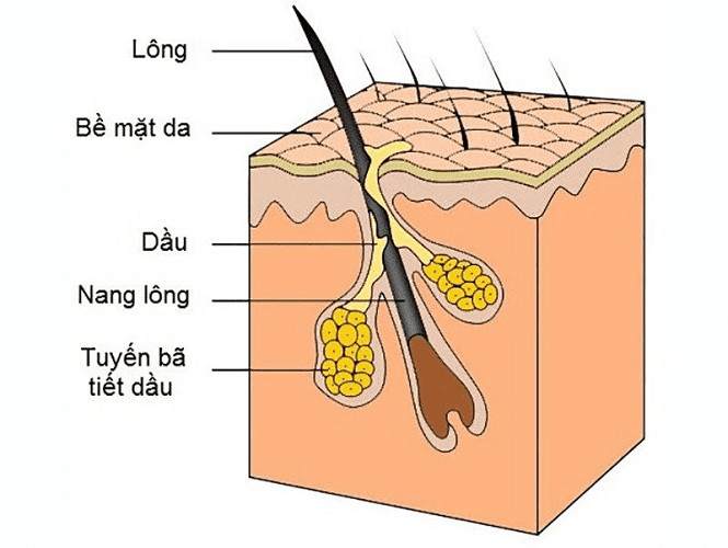 Nguyên Nhân Gây Mụn và Cách Chăm Sóc Da Hiệu Quả