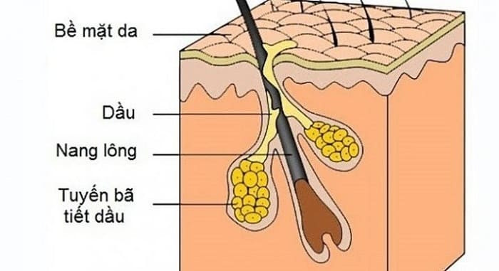 Cơ chế hình thành mụn cám trên da