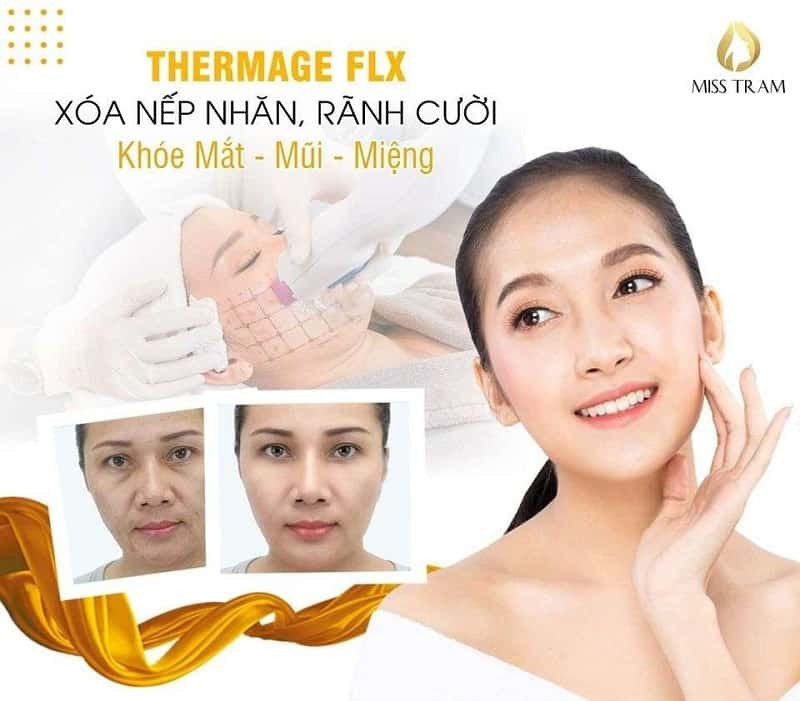 Cải Thiện Nếp Nhăn, Rãnh Cười Bằng Công Nghệ Thermage FLX: Giải Pháp Hiệu Quả Cho Làn Da Khỏe Mạnh