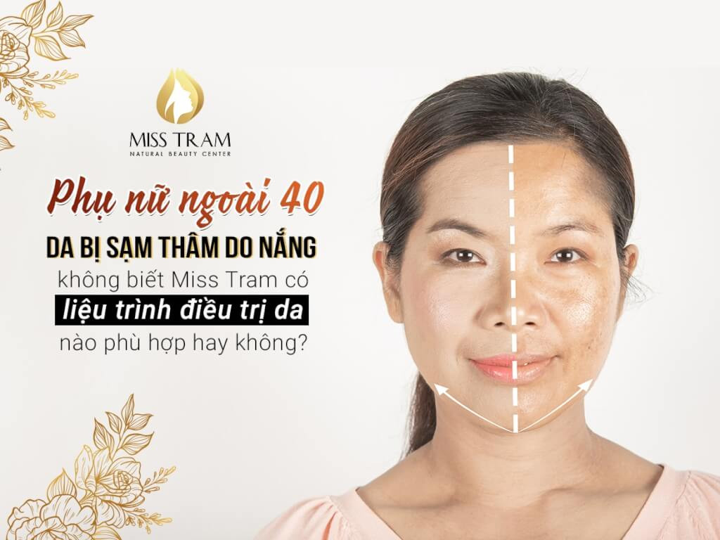 Cách Điều Trị Da Bị Sạm, Thâm Cho Phụ Nữ Ngoài 40 Tuổi