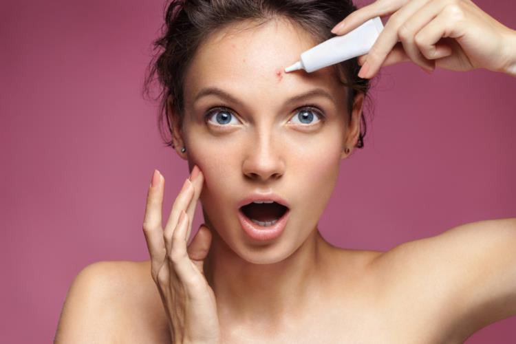 Giải pháp điều trị mụn an toàn