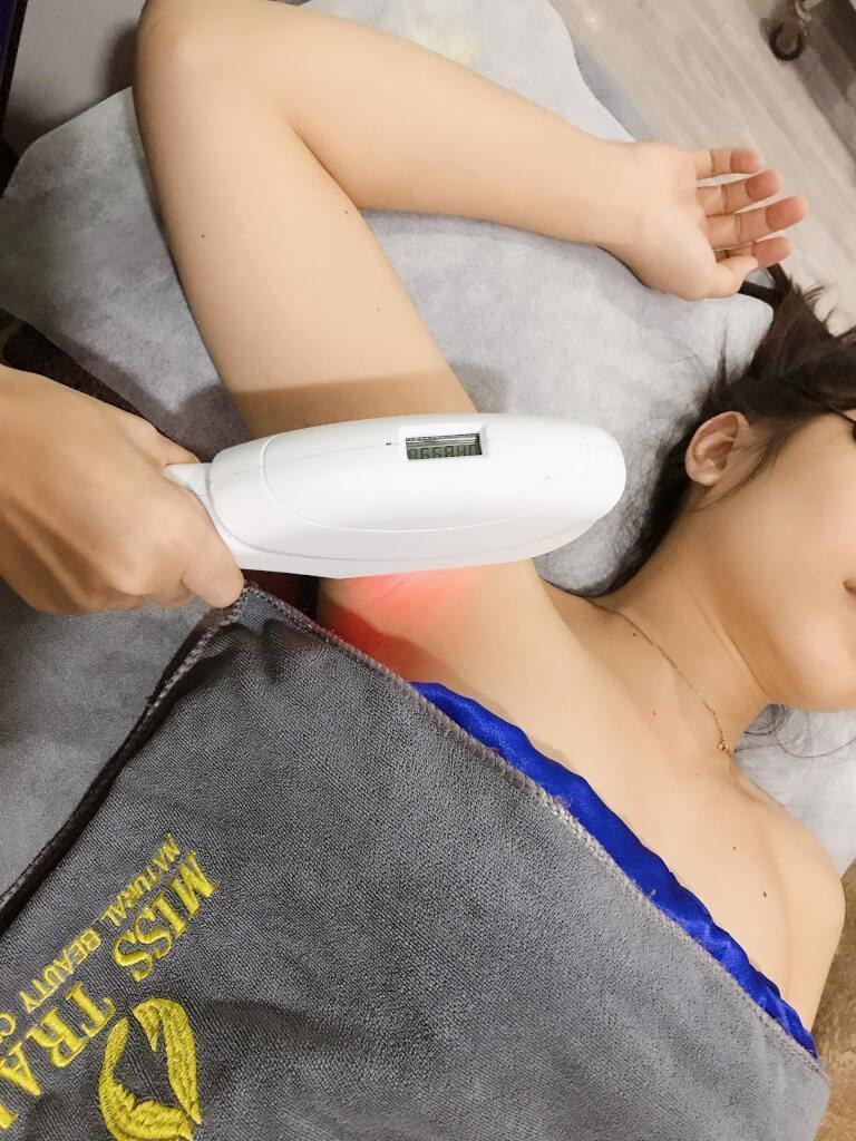 Giải pháp triệt lông an toàn