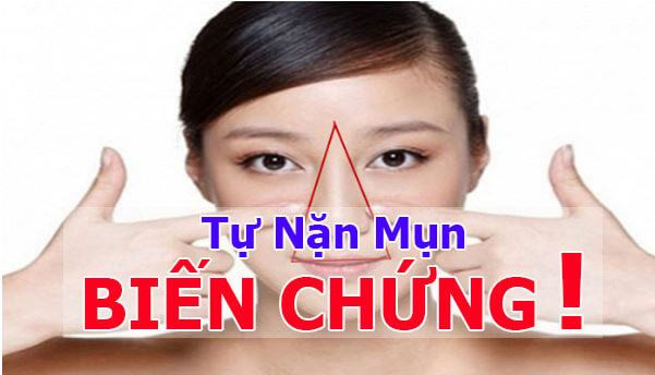 Không tự ý nặn mụn