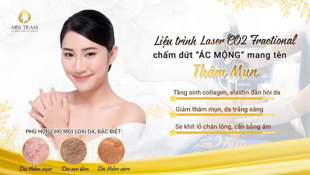 Giải quyết vấn đề thâm mụn hiệu quả với liệu trình Laser CO2 Fractional