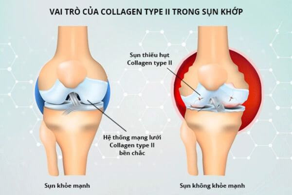 Lợi ích của collagen đối với xương