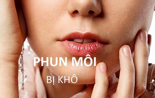 Môi bị thâm