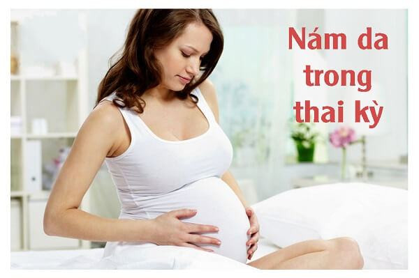 Nám và Sạm Da Khi Mang Thai: Nguyên Nhân Và Cách Khắc Phục