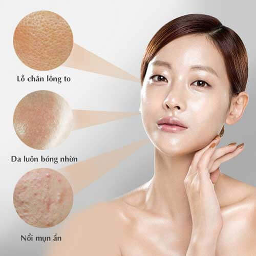 Nguyên nhân da nhờn dễ bị lão hóa