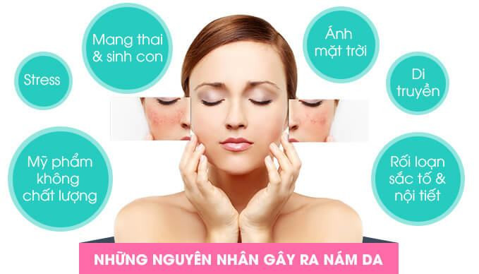 Nguyên nhân khiến nám da xuất hiện