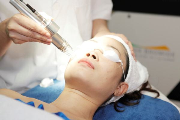 Quy trình điều trị xóa tàn nhang bằng laser