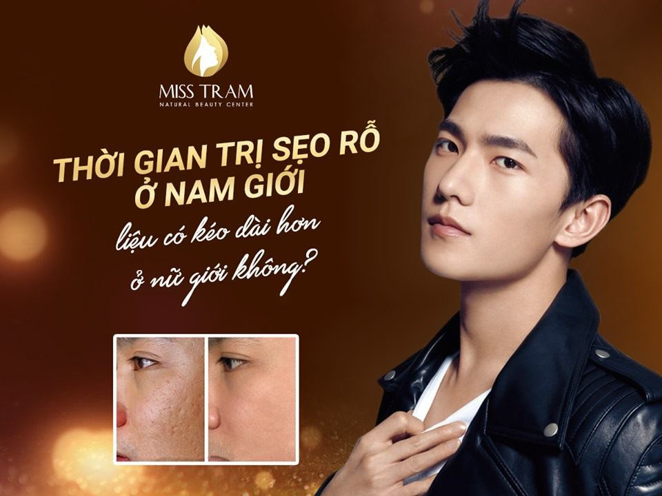 Thời Gian Trị Sẹo Rỗ ở Nam Có Kéo Dài Hơn Nữ Không?