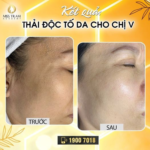 Thực phẩm giải độc da hiệu quả